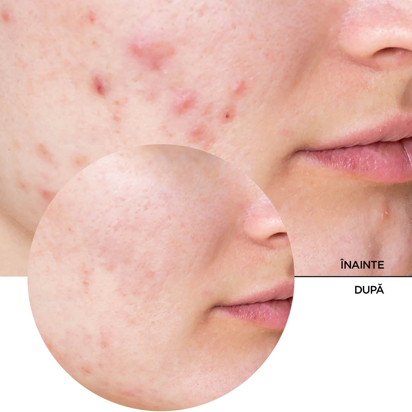Just niacinamide 10%, 30 ml